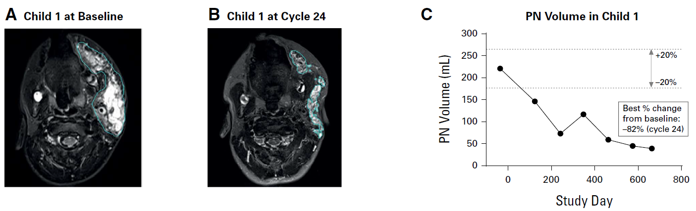 출처: J Clin Oncol. 43:716-729.