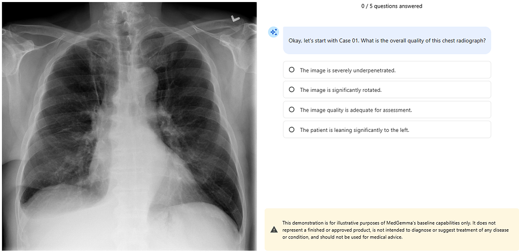 (실습) 나만의 의료 AI 멘토 만들기 (MedGemma 활용)의 썸네일 이미지