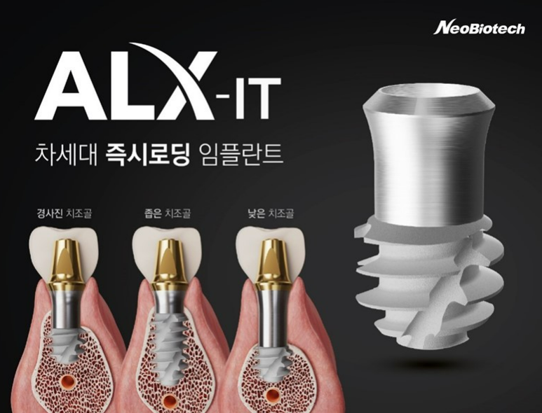 'ALX-IT' 임플란트 광고 사진 / 네오바이오텍 제공