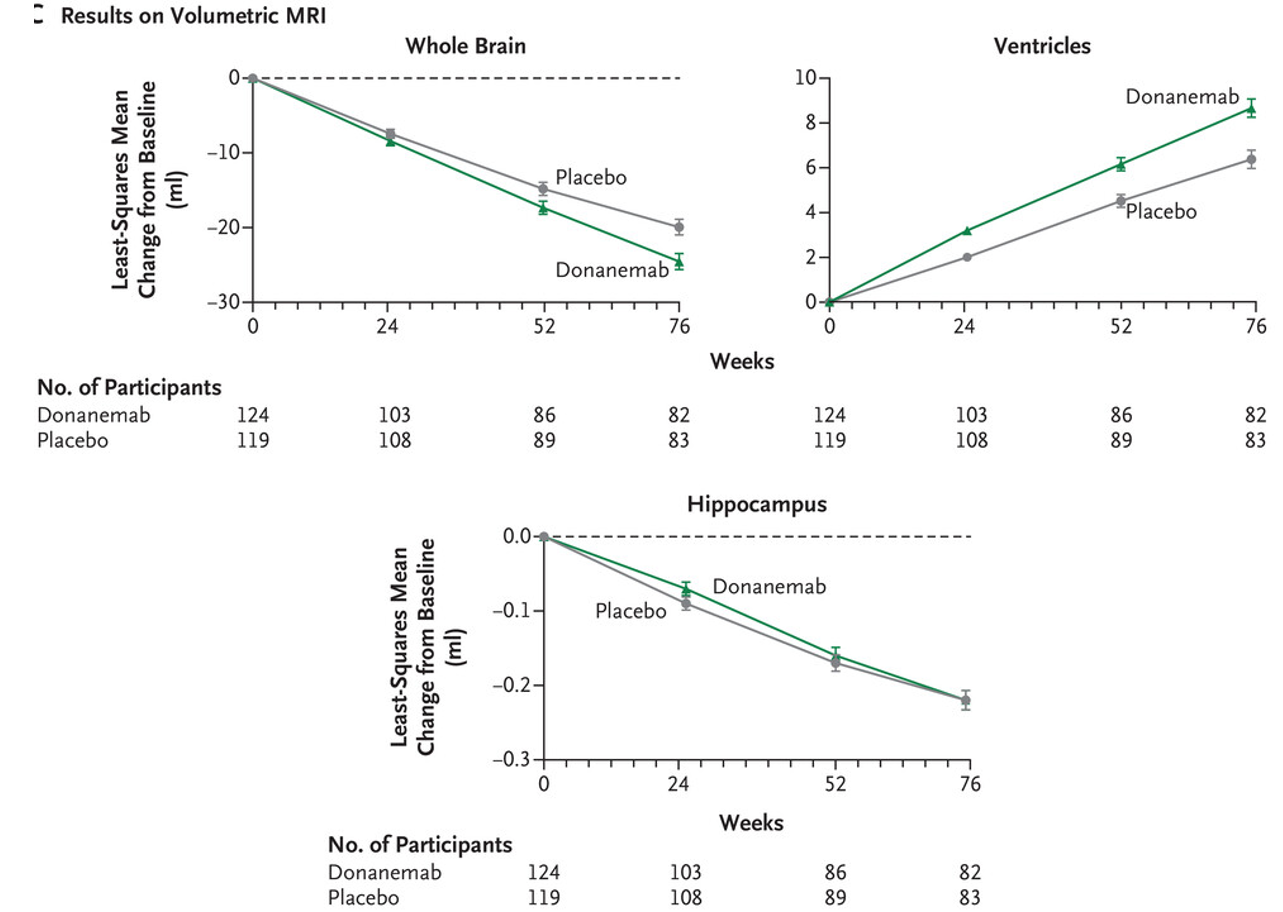 뇌 전체, 측두뇌실, 해마 부피와 donanemab의 연관성