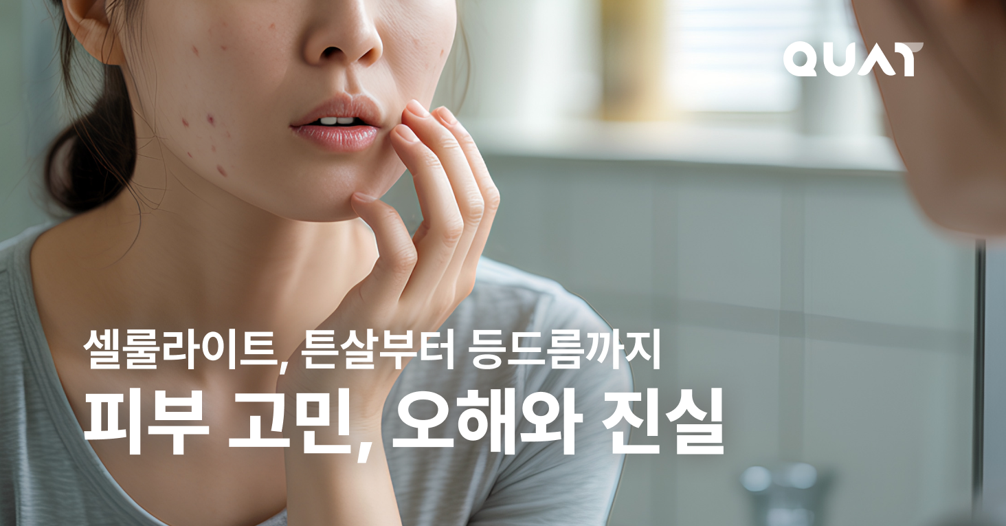 셀룰라이트·튼살·등드름… 왜 생길까?의 썸네일 이미지