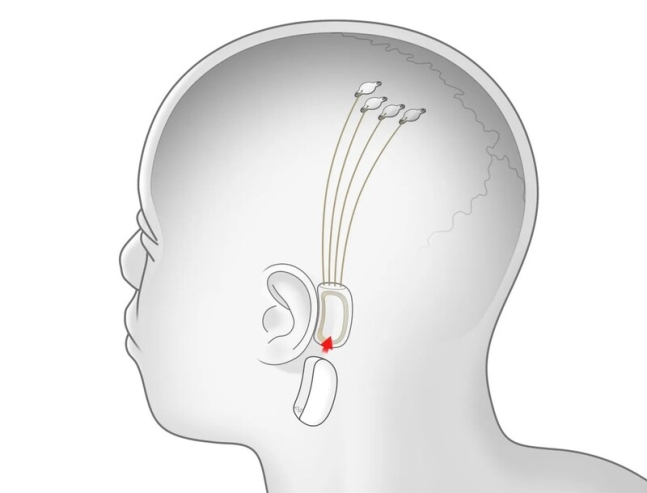 이미지 = 뉴럴링크