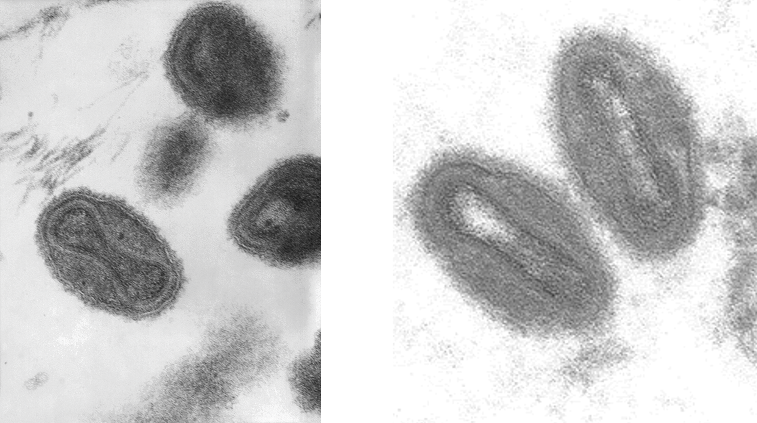 (왼쪽) 치명적인 천연두를 일으키는 대두창 바이러스(Variola major)입니다. (오른쪽) 원숭이 두창 바이러스입니다.