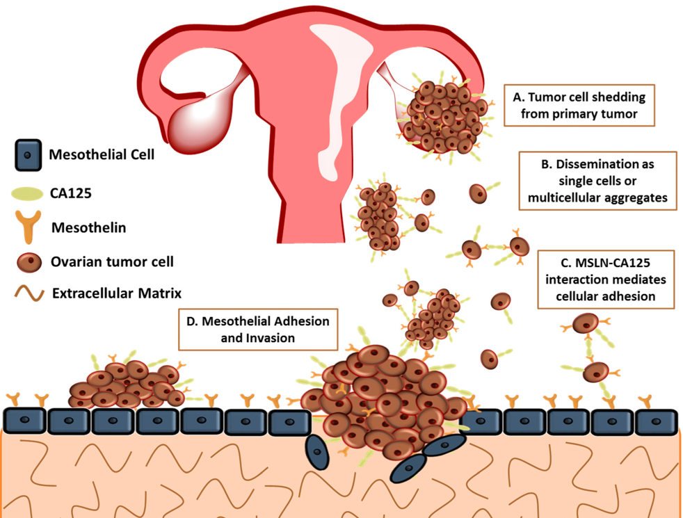 출처: Cancers | Free Full-Text | The Impact of Mesothelin in the Ovarian Cancer Tumor Microenvironment (mdpi.com)