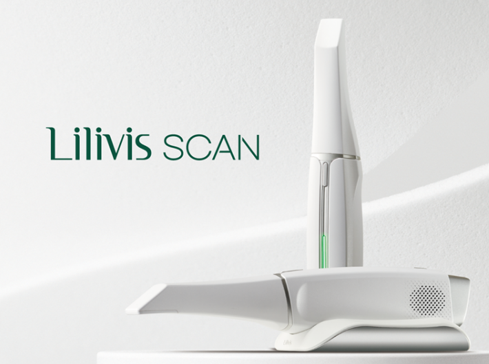 메탈스캔 구강스캐너 'Lilivis Scan' 제품 사진 / 휴비츠 제공