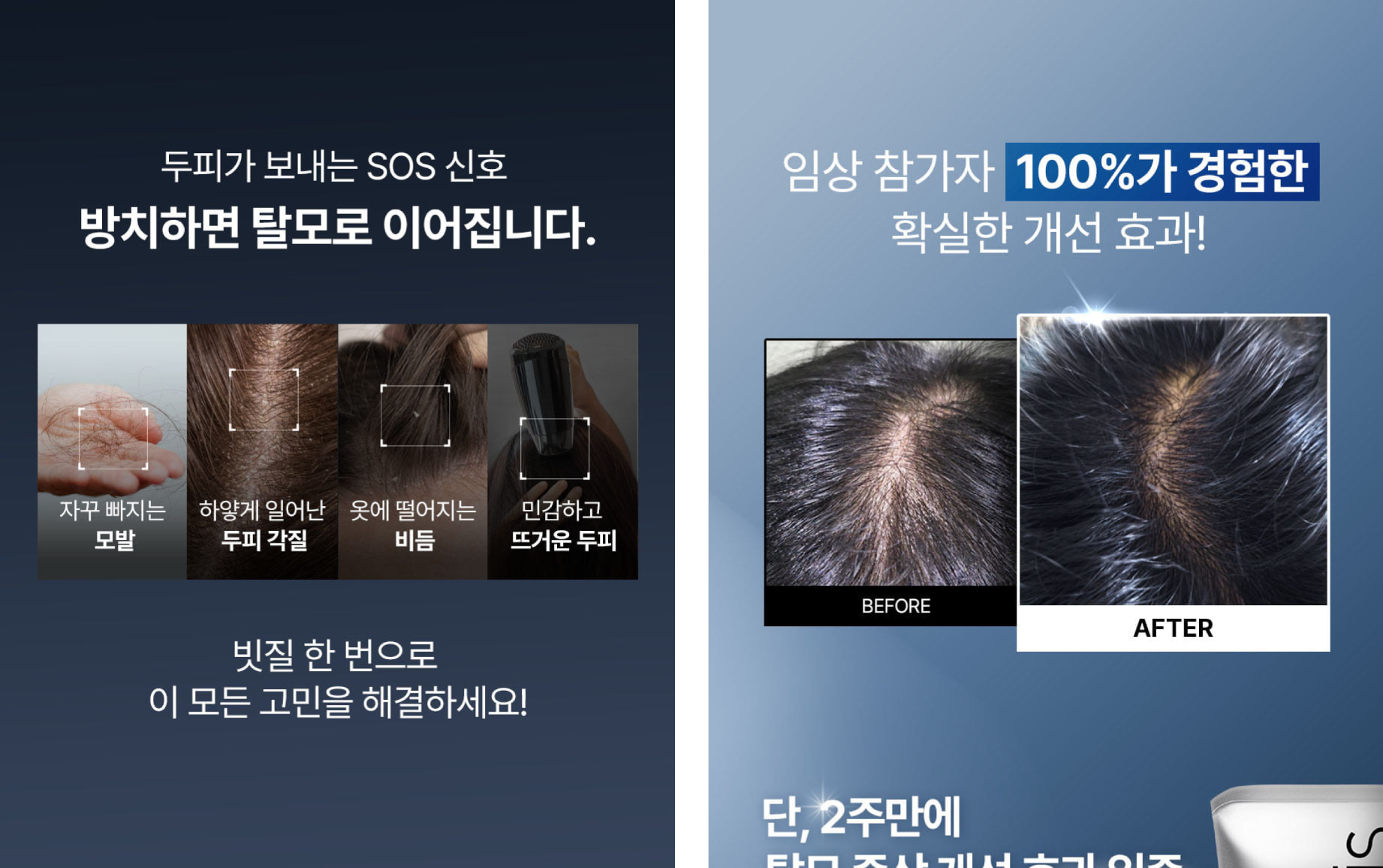 출처 - 에이페(apais) 자사몰