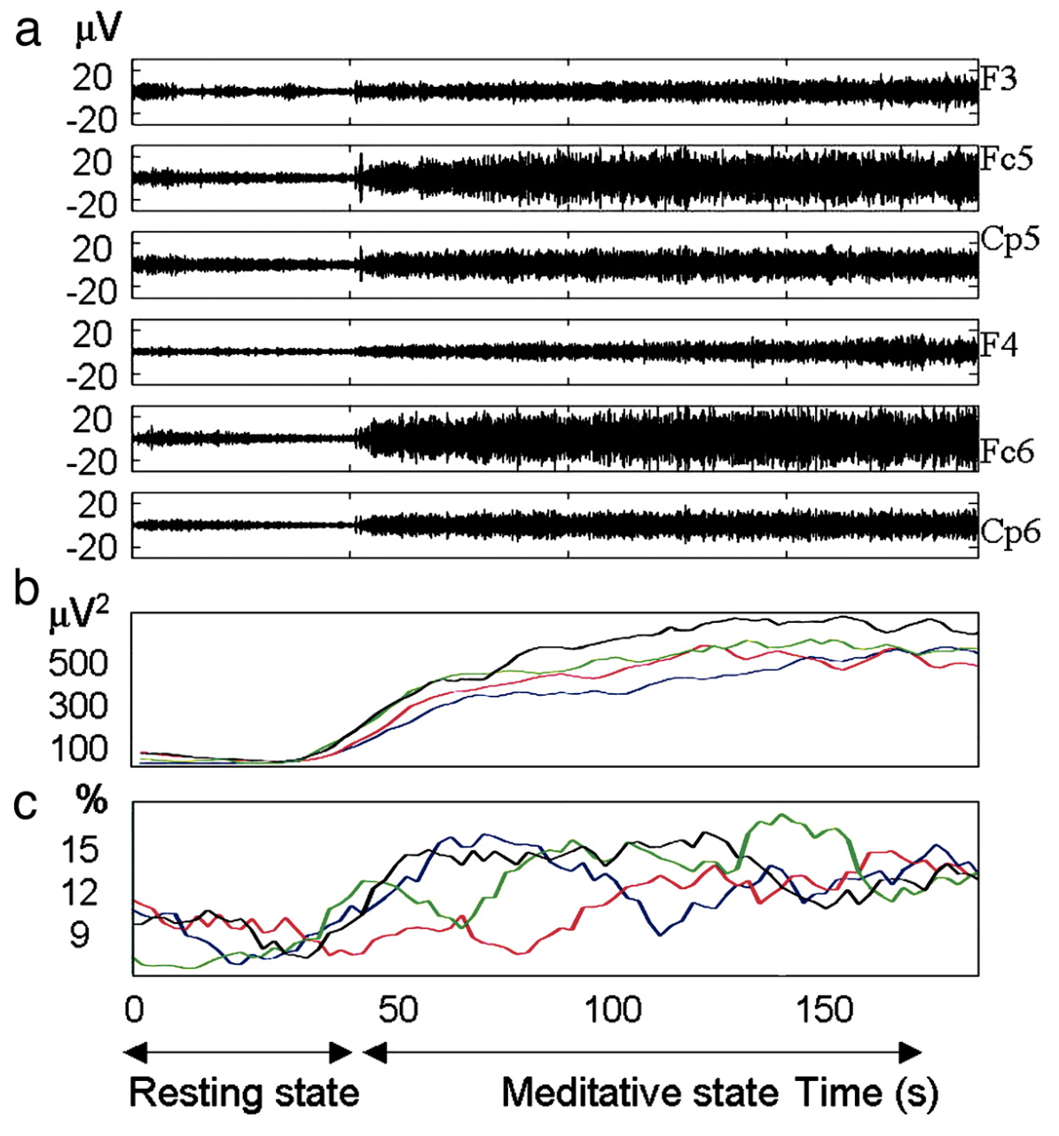 데이비슨 박사가 실험한 티베트 승려의 뇌파, 명상하는 동안 감마파가 크게 진동한다.