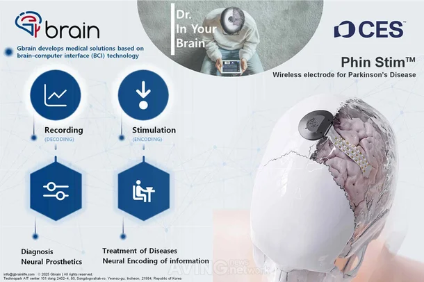 이미지 출처=지브레인