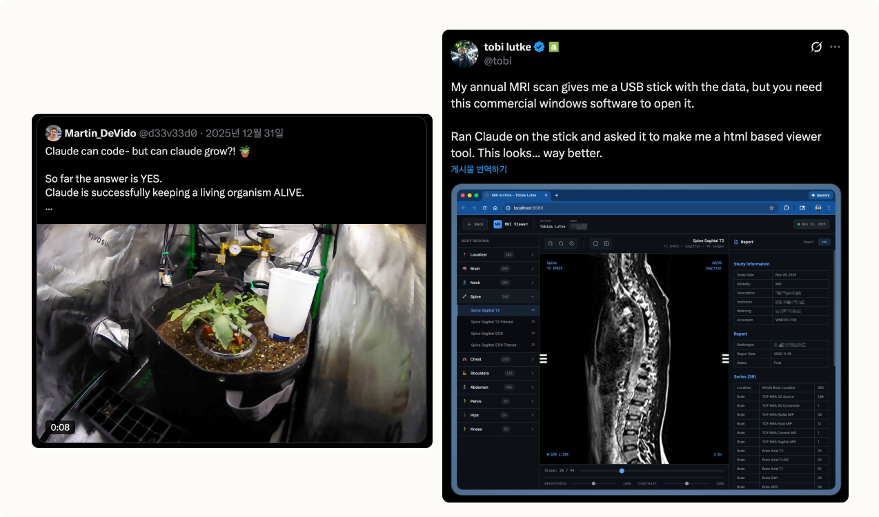 클로드 코드를 이용해 토마토 재배를 하거나, MRI를 분석하는 사람들이미지 출처 : X