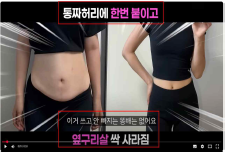 AI 생성 before-after 사진 조작하여 화장품을 의약품으로 오인하게 만드는 부당광고