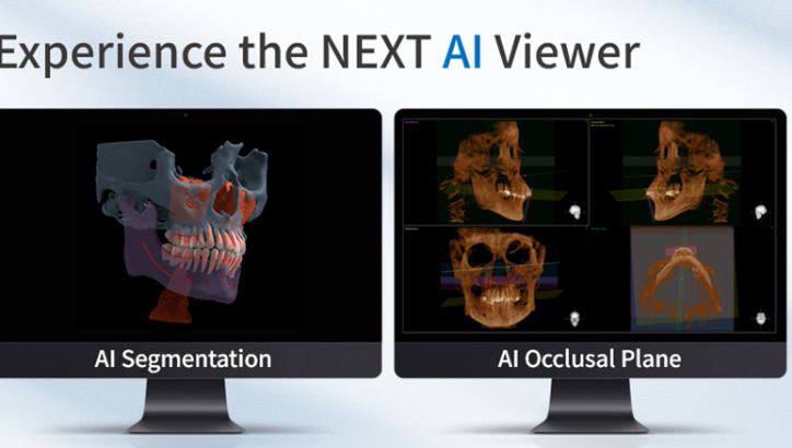 덴티움 'Bright CT'의 AI Viewer 사진 / 덴티움 제공