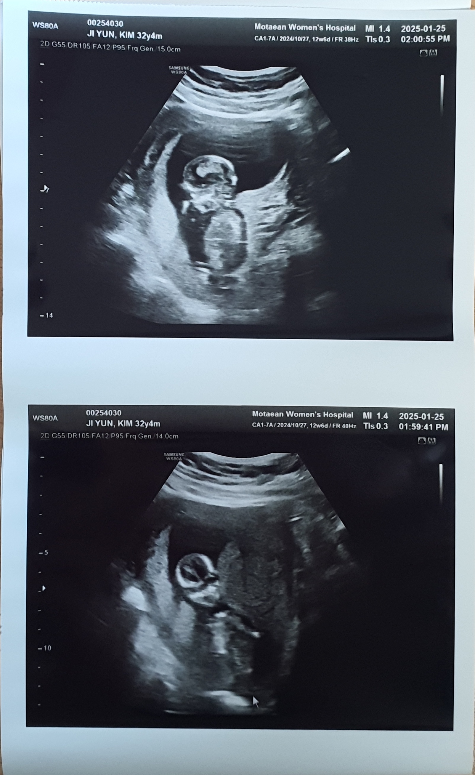 제법 인간 모양을 띄게 됐던 아기.