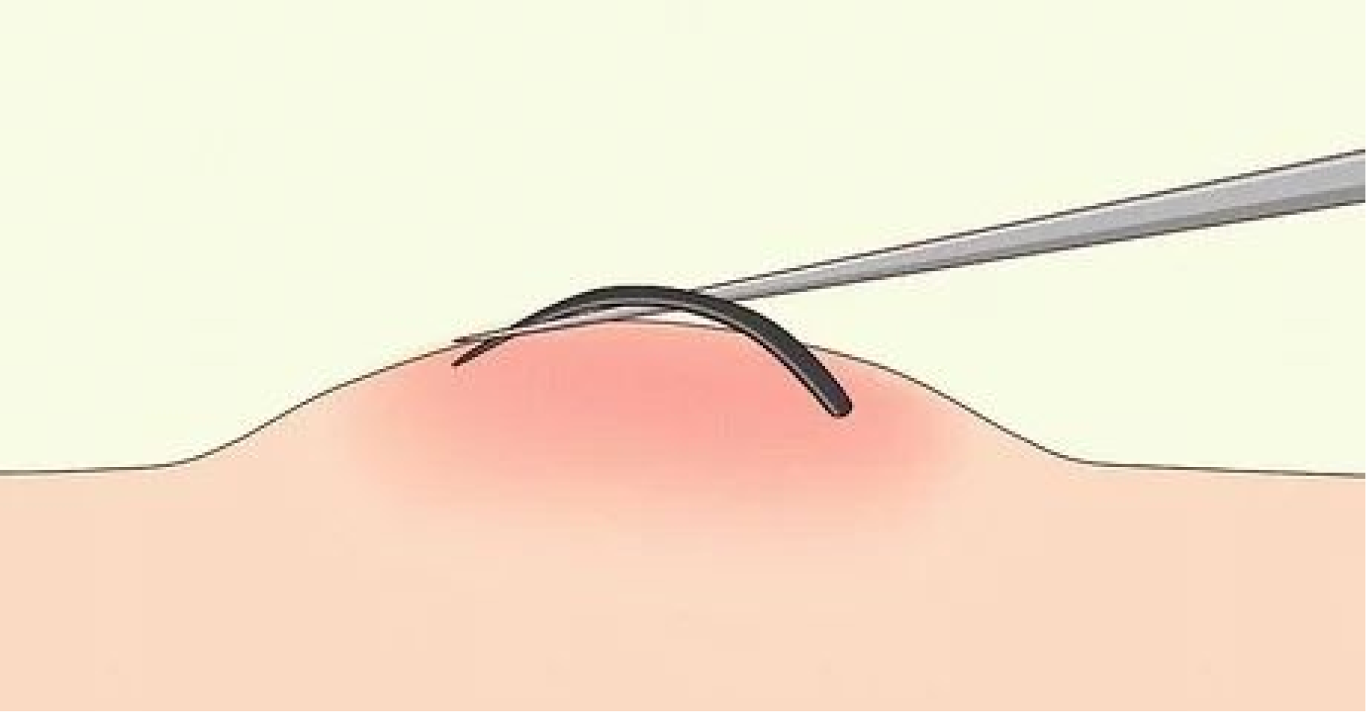 © wikihow