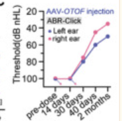 AAV-Mediated Gene Therapy Restores Hearing in Patients with DFNB9 Deafness