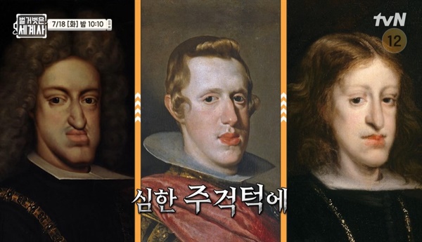 근친혼으로 인해 유전병을 앓은 합스부르크 가문 사람들 (출처: 벌거벗은 세계사)