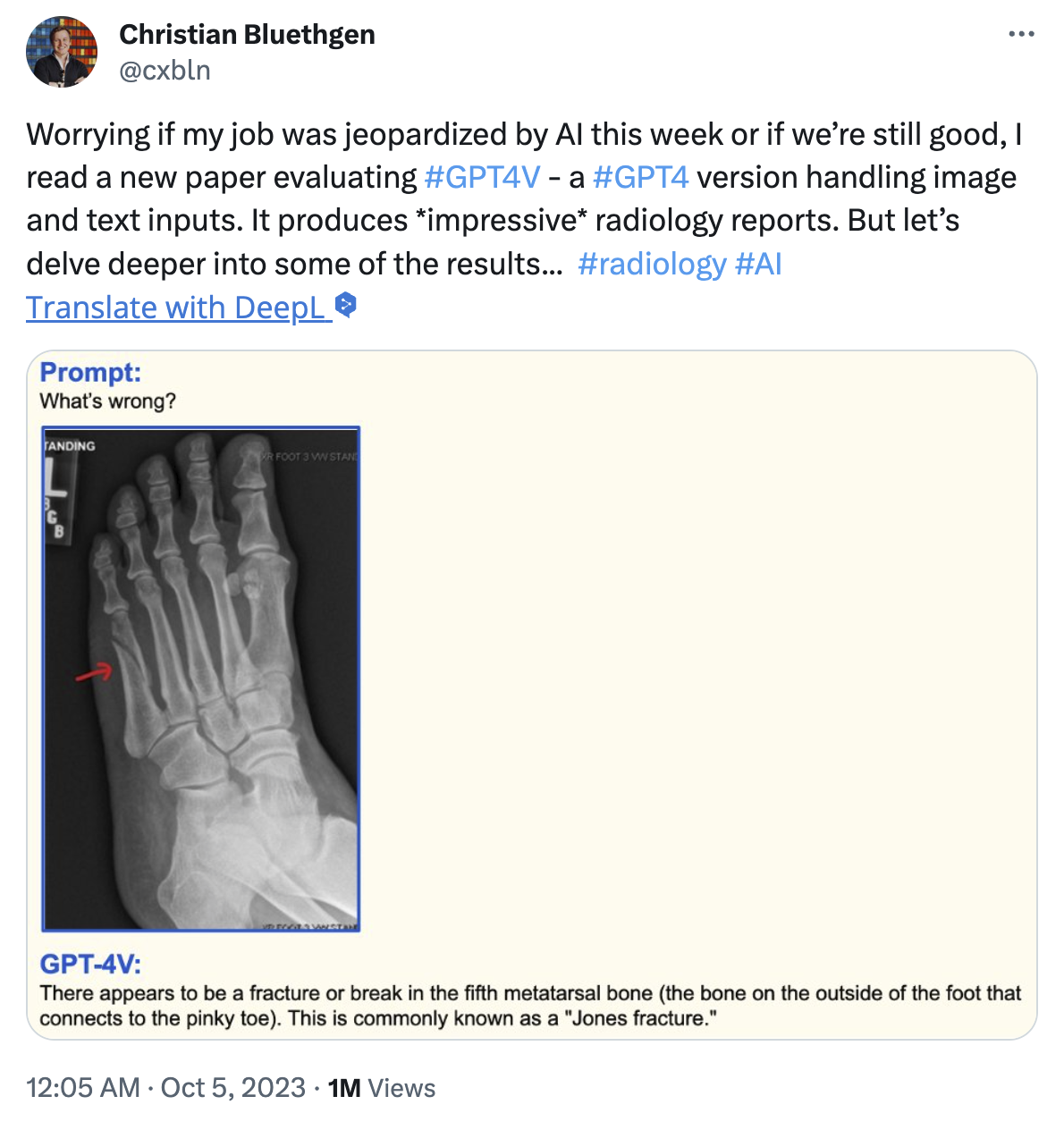 X-ray 사진 판독 사례