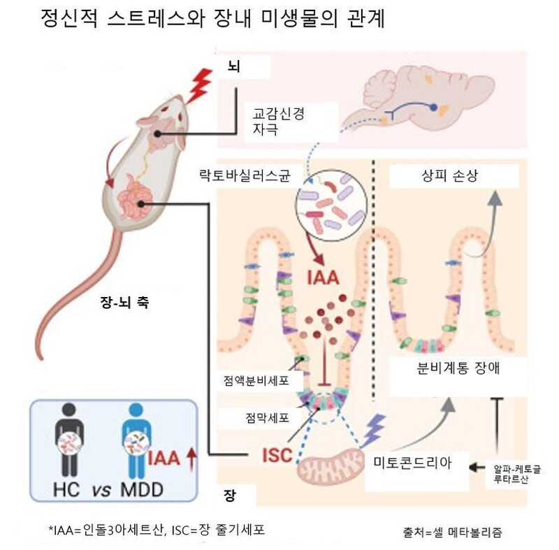 과민성대장증후군(IBS) 과 스트레스의 썸네일 이미지