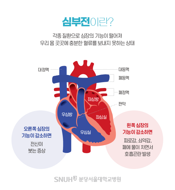 출처:&nbsp;https://www.snubh.org/service/info/com/view.do?cPage=2&BNO=472&Board_ID=B004&RNUM=15
