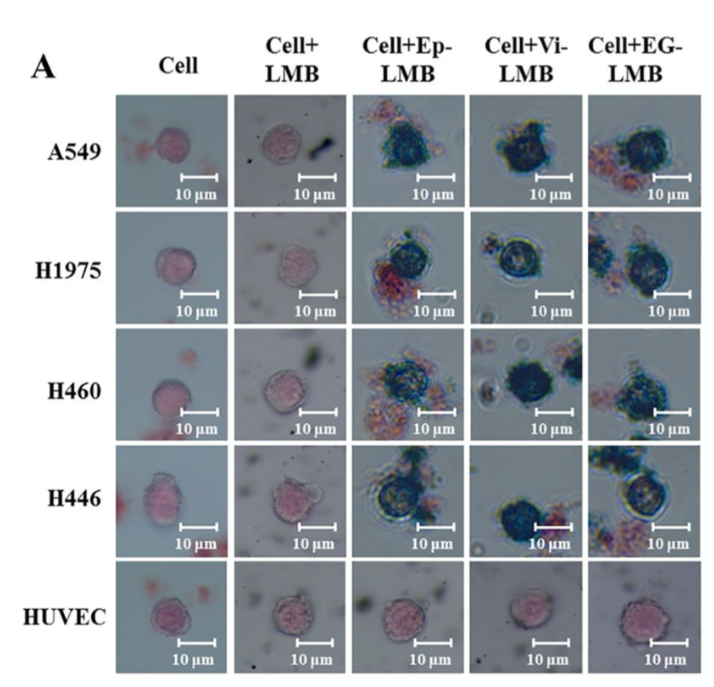 출처 : Jiang, W., Wu, J., Lin, X., Chen, Z., Lin, L., & Yang, J. (2024). Enumeration and Molecular Characterization of Circulating Tumor Cell Using an Epithelial Cell Adhesion Molecule/Vimentin/Epidermal Growth Factor Receptor Joint Capture System in Lung Cancer. Clinical Medicine Insights. Oncology, 18, 11795549241231568.