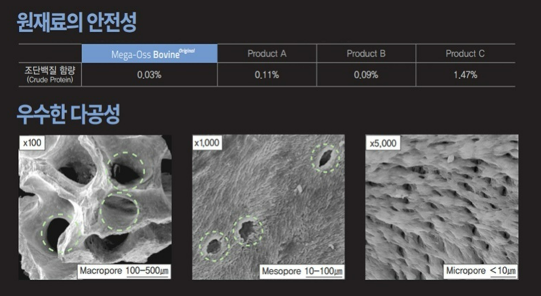 Mega-Oss Bovine Original 참조 자료 / 메가젠임플란트 제공