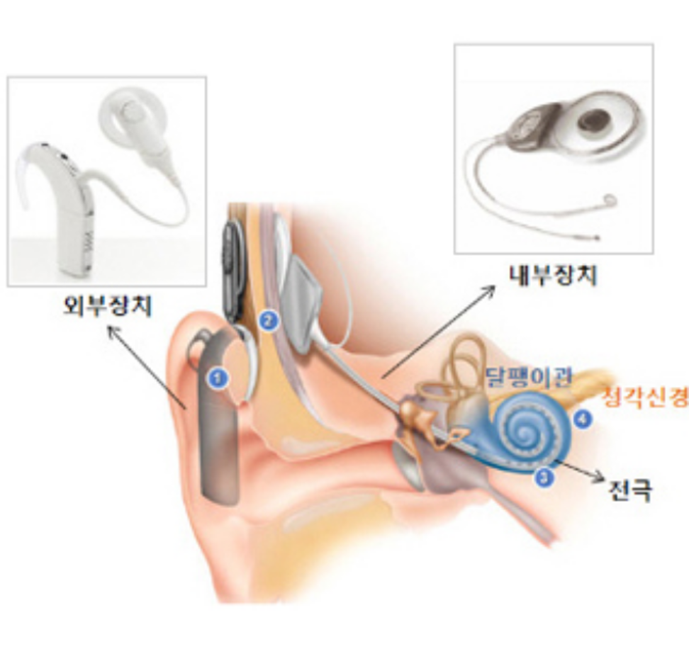 출처 : https://www.snubh.org/upload/editor/dept/09_15.jpg