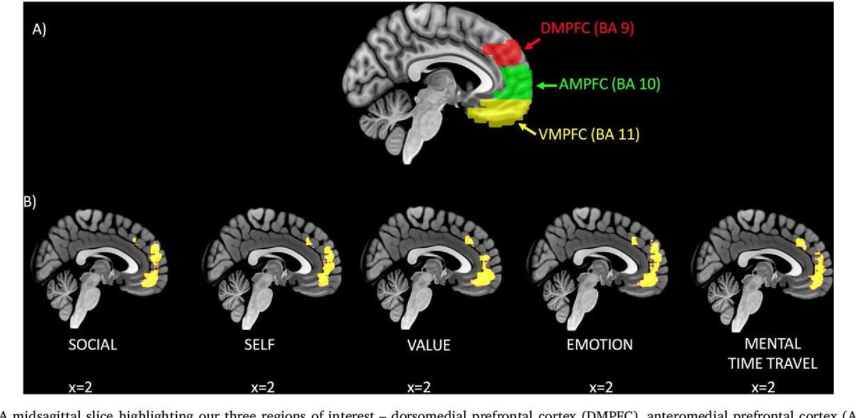 DMPFC, AMPFC, VMPFC 모두 내측전전두피질에 포함되는 하위영역임
