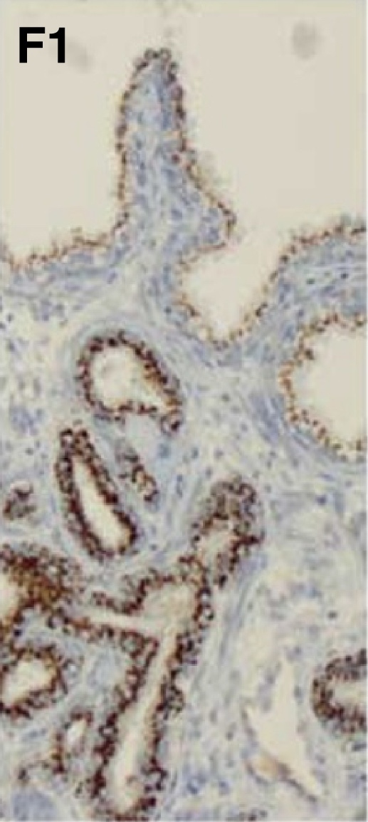 선정 논문의 Figure 2-F1